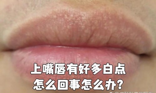 万松堂圣宝茶的功效-专业万松堂的产品有哪些平台-万松堂减肥茶管用吗